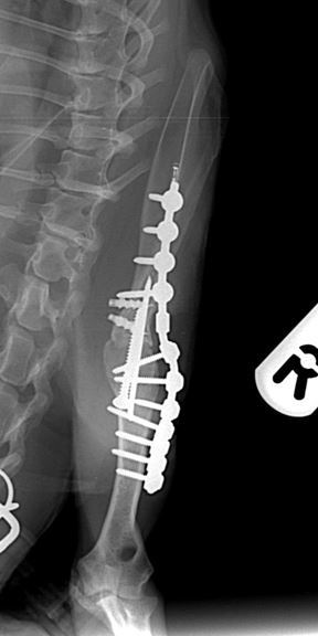 radiographs of the arthrodesed shoulder 6 weeks after surgery